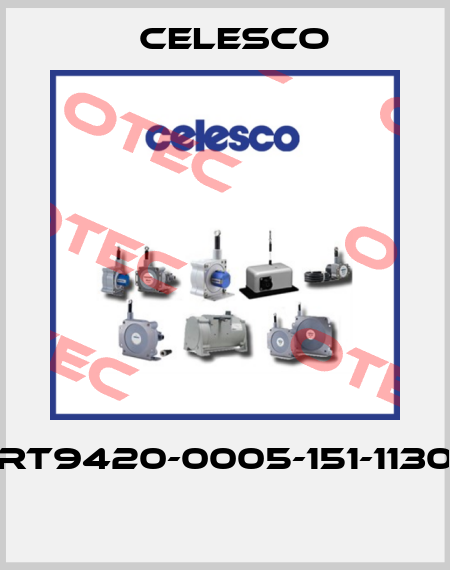 RT9420-0005-151-1130  Celesco